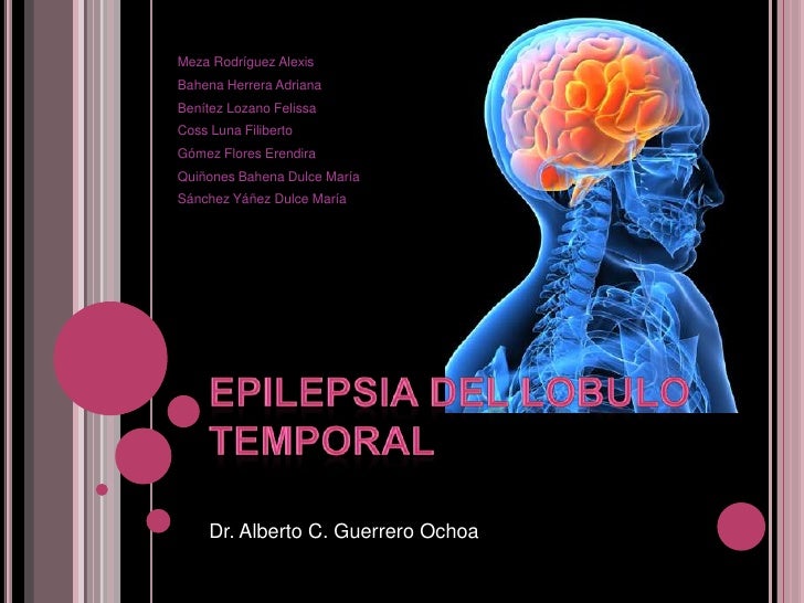 epilepsia del lobulo temporal mesial